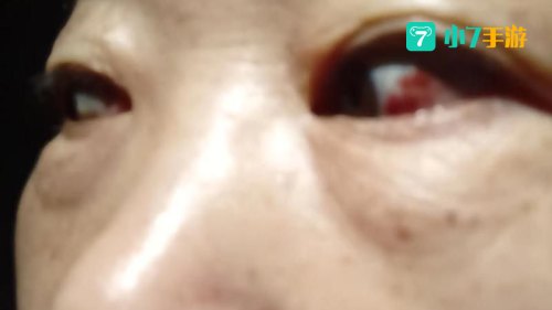 老瞎眼